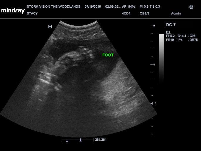 201607191409300181OB