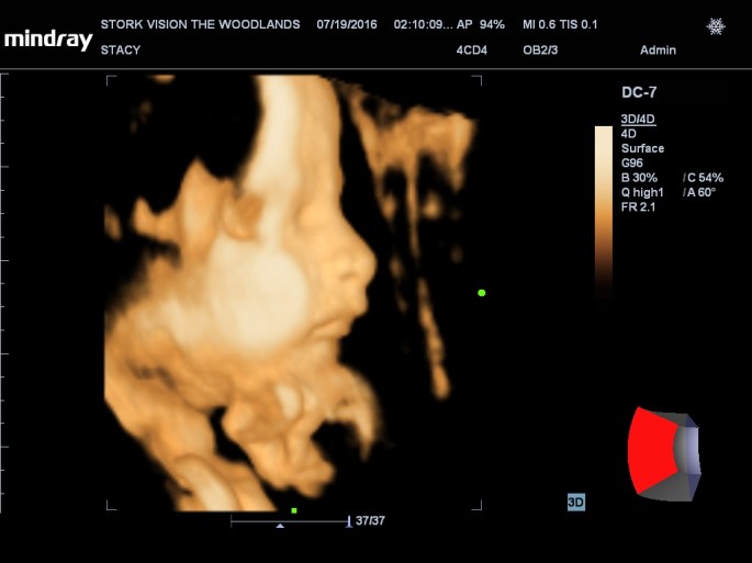 201607191410170185OB