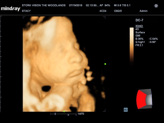 201607191414070193OB