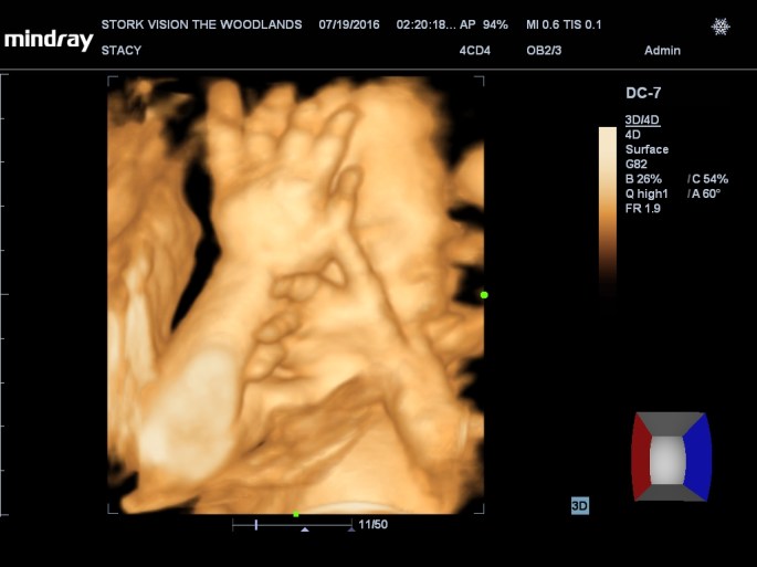 201607191420320246OB