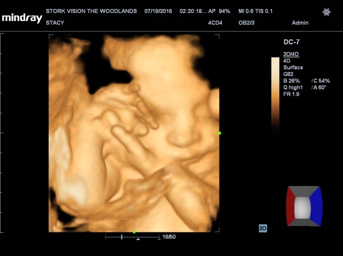 201607191420370248OB