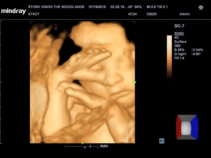 201607191420560255OB